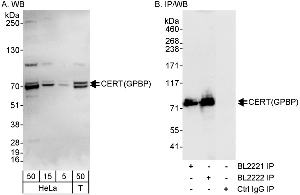 Anti-CERT/GPBP