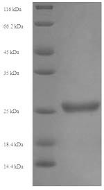 Killer cell immunoglobulin-like receptor 2DS1 (KIR2DS1), partial, human, recombinant