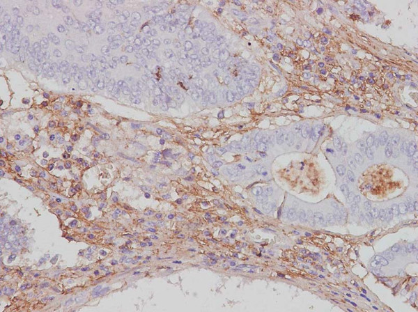Anti-CTLA4