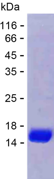 Recombinant Human RBMY1J Protein