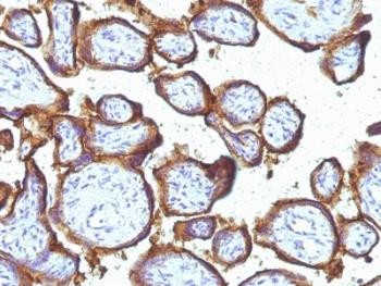 Anti-EGFR, clone 31G7