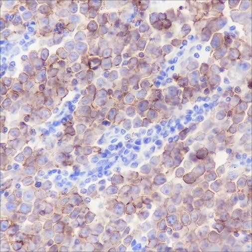 Anti-Recombinant c-Kit, clone A186