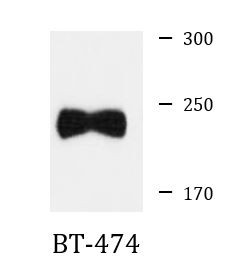 Anti-PHLPP1