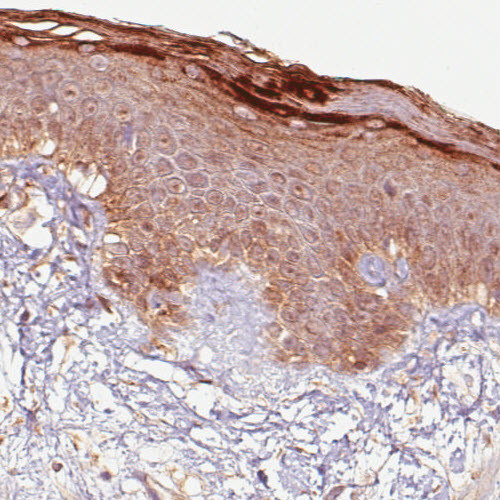 Anti-RNASE7, clone CL0224