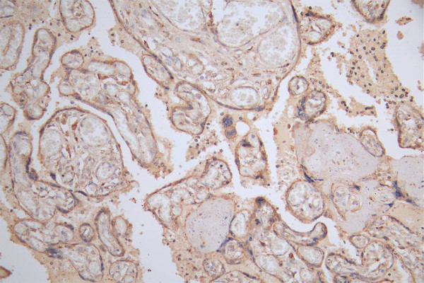 Anti-GAA Recombinant Monoclonal, clone 5E5