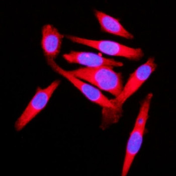 Anti-KLC1 / Kinesin light chain 1