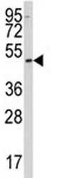 Anti-SSB / Lupus La protein