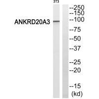 Anti-ANKRD20A3