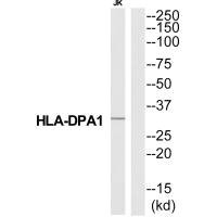 Anti-HLA-DPA1