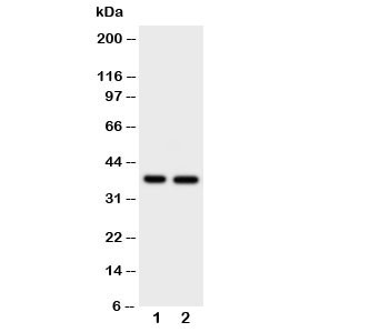 Anti-MCL-1