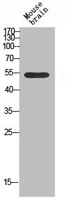 Anti-KCNK3