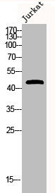 Anti-Phospho-DUSP1/DUSP4 (S296/318)