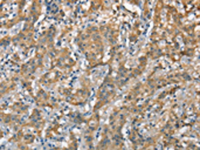 Anti-CSMD1
