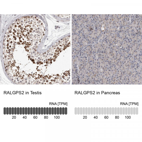 Anti-RALGPS2