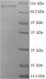 Peroxisomal bifunctional enzyme (EHHADH), human, recombinant