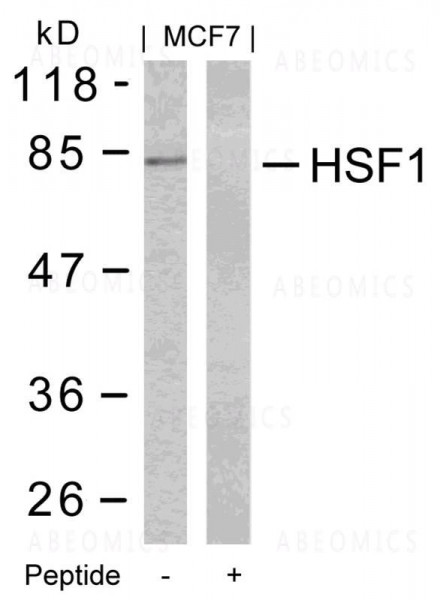 Anti-HSF1 (Ab-303)