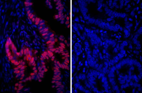 Anti-Rabbit IgG-heavy and light chain cross-adsorbed, DyLight(R) 594 conjugated