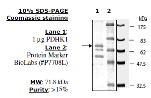 PDHK1 Human Recombinant Protein