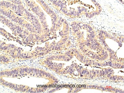 Anti-STAT1, clone 8H11