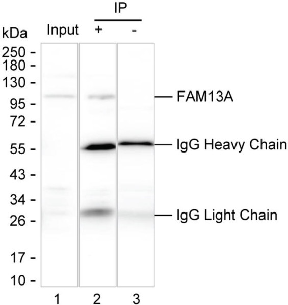 Anti-FAM13A
