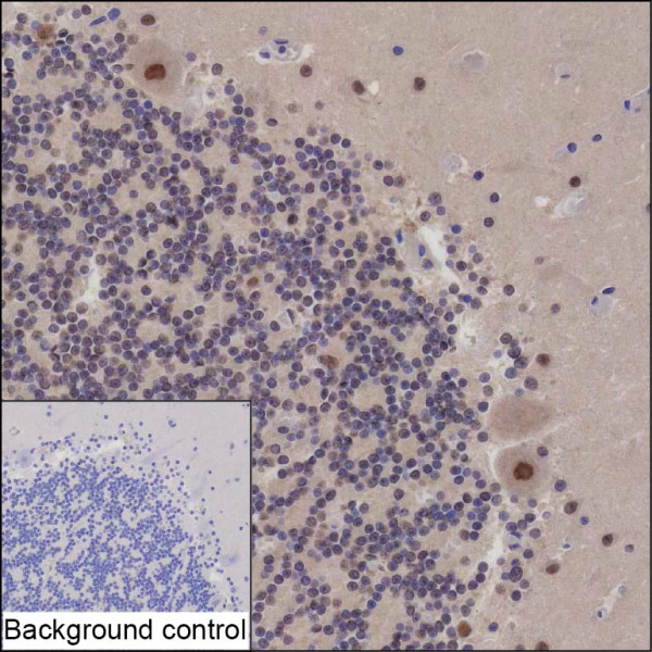 Anti-CUL5