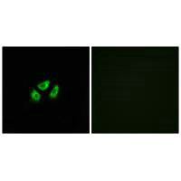 Anti-SCN7A