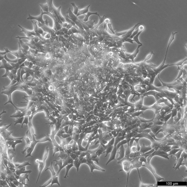 LNCaP clone FGC Cells