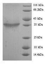 Toxin zeta, Streptococcus agalactiae, recombinant