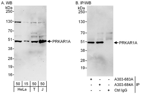Anti-PRKAR1A