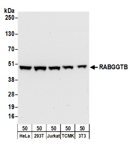 Anti-RABGGTB