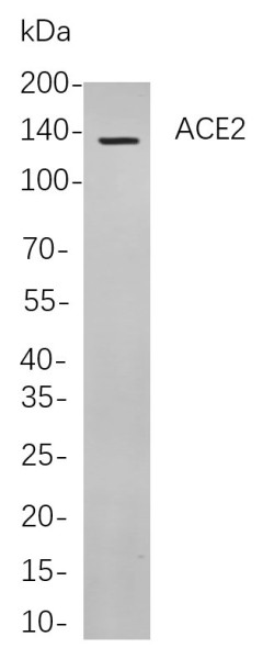 Anti-Recombinant ACE2, clone 7A5