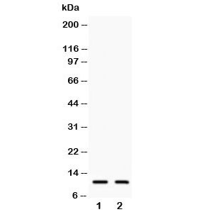 Anti-Eotaxin 3