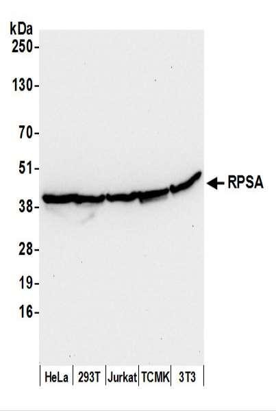 Anti-RPSA
