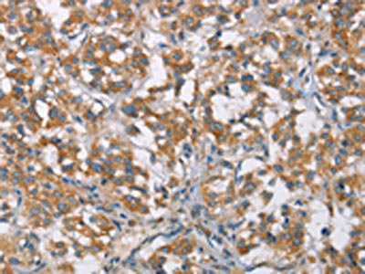 Anti-TLR6