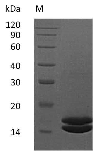 Interleukin-2 (IL2) (Active), human, recombinant
