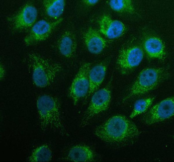 Anti-GK2 / Glycerol kinase 2