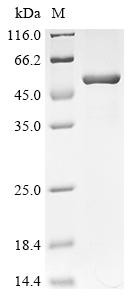 Succinyl-CoA ligase [ADP-forming] subunit beta, mitochondrial (SUCLA2), human, recombinant