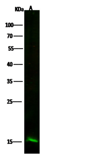 Anti-Profilin 2/PFN2 Monoclonal Recombinant Antibody