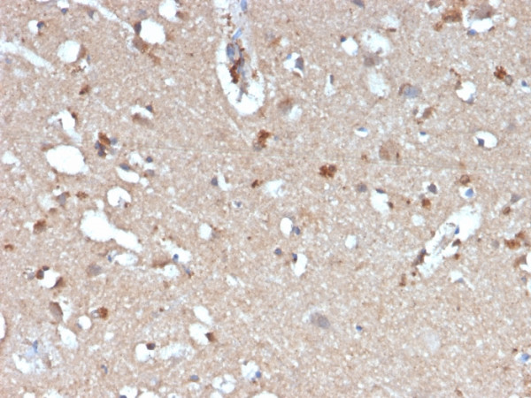 Anti-beta Amyloid, clone APP/3345