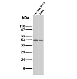 Anti-SOX10 / SRY-box transcription factor 10, clone rSOX10/13506