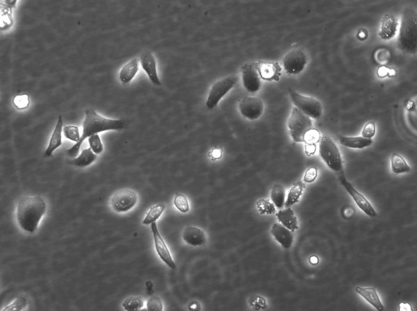SCL II Cells
