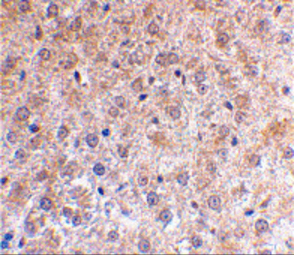 Anti-p53DINP1
