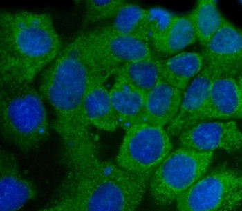 Anti-SSH3BP1