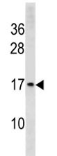 Anti-Histone H3