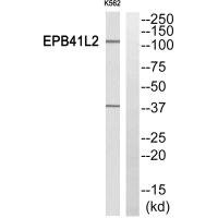 Anti-EPB41L2