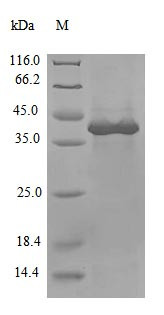 Non-structural protein 3 (nsp3), partial, Severe acute respiratory syndrome coronavirus 2, recombina