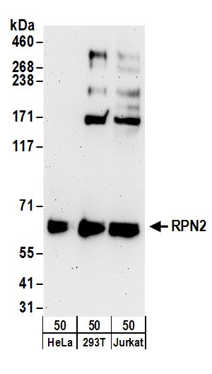 Anti-RPN2