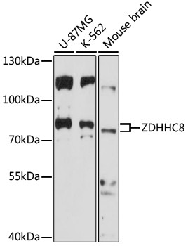 Anti-ZDHHC8