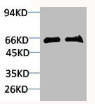 Anti-SLC6A1