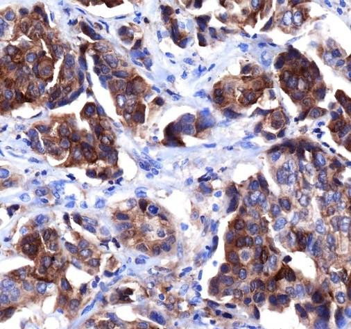 Anti-Recombinant HER4/ErbB4, clone A584